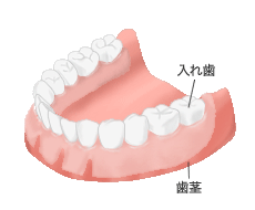 総入れ歯