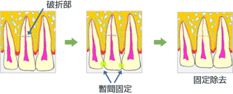 処置