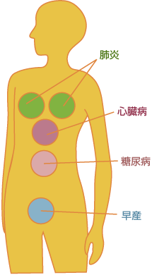 全身図