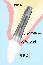 正常像