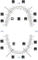 舌側、口蓋側、唇側、頬側